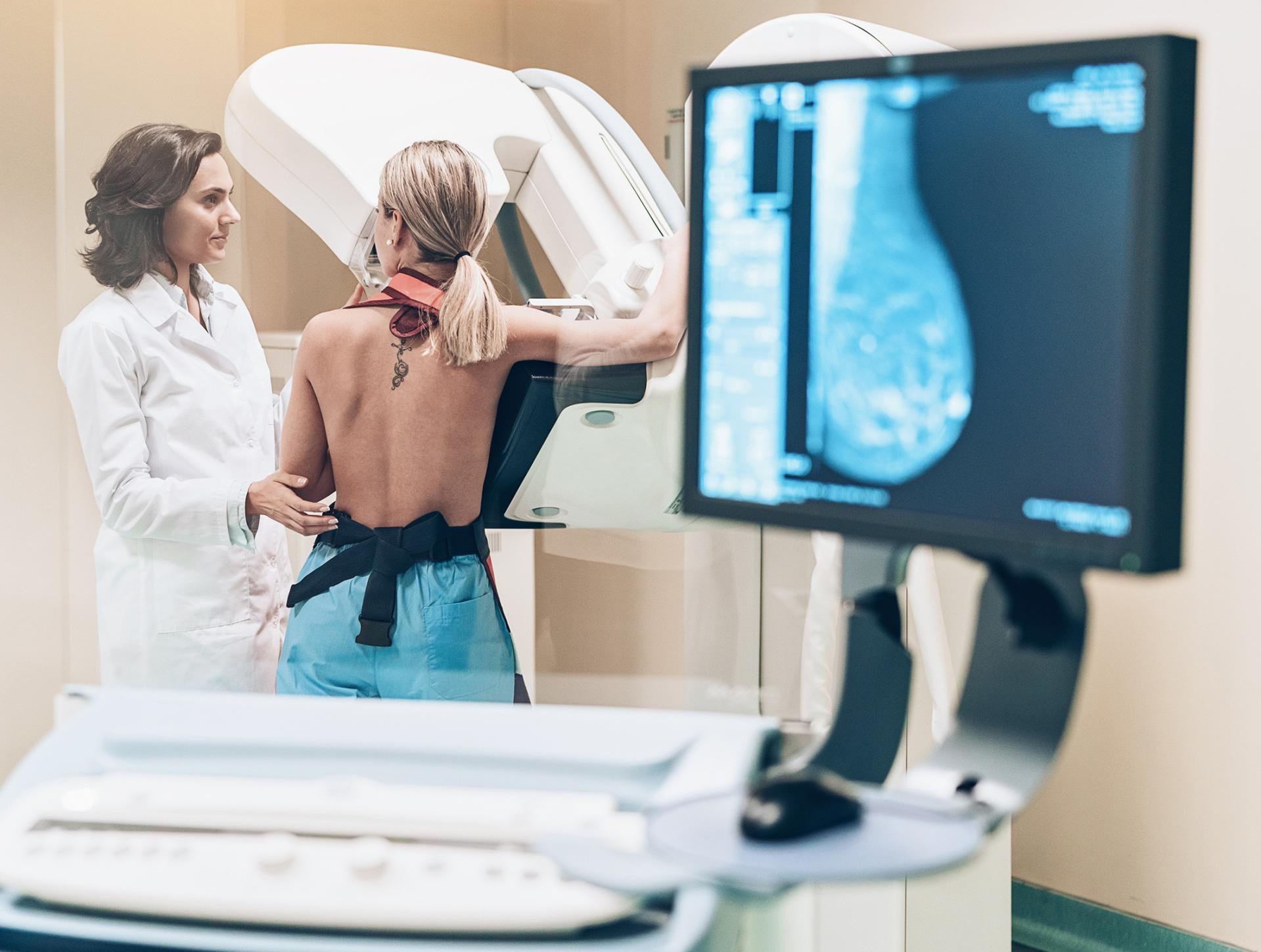 Eine Patientin steht vor dem Mammografie Gerät und lässt eine Mammografie durchführen.